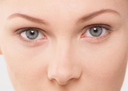 blefaroplastika-4